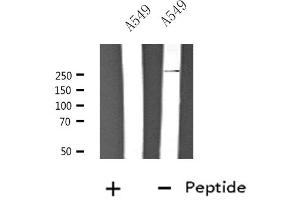 Western blot analysis of extracts from A549 cells, using CACNA1H antibody. (CACNA1H antibody  (Internal Region))