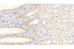 Detection of Surv in Human Stomach Tissue using Polyclonal Antibody to Survivin (Surv) (Survivin antibody  (AA 1-142))