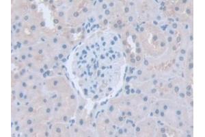 Detection of ITSN1 in Rat Kidney Tissue using Polyclonal Antibody to Intersectin 1 (ITSN1) (ITSN1 antibody  (AA 1-227))
