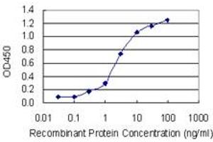 Detection limit for recombinant GST tagged PHIP is 0. (PHIP antibody  (AA 1599-1705))
