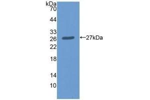 Detection of Recombinant ME2, Human using Polyclonal Antibody to Malic Enzyme 2, NADP+ Dependent, Mitochondrial (ME2) (Malic Enzyme 2, NADP+ Dependent, Mitochondrial (AA 220-426) antibody)