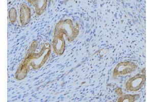 ABIN6275364 at 1/100 staining Human uterus tissue by IHC-P. (SERPING1 antibody  (Internal Region))