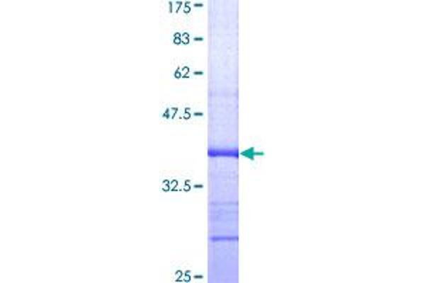 DNASE1L3 Protein (AA 51-150) (GST tag)