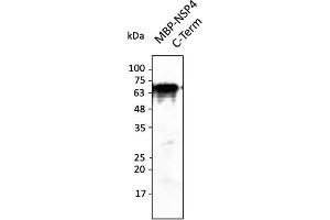 Western Blotting (WB) image for anti-SARS-CoV-2 Non-Structural Protein 4 (NSP4) (C-Term) antibody (ABIN7272999) (SARS-CoV-2 NSP4 antibody  (C-Term))