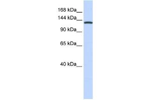 WB Suggested Anti-VARS Antibody Titration:  0. (VARS antibody  (Middle Region))