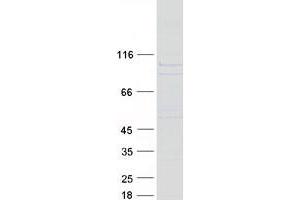 Validation with Western Blot