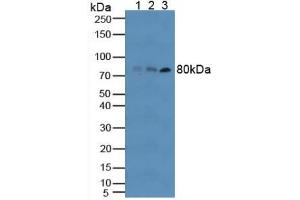 Western blot analysis of (1) Human RAW2647 Cells, (2) Human HT-1080 Cells and (3) Human Blood Cells. (TLR6 antibody  (AA 608-796))