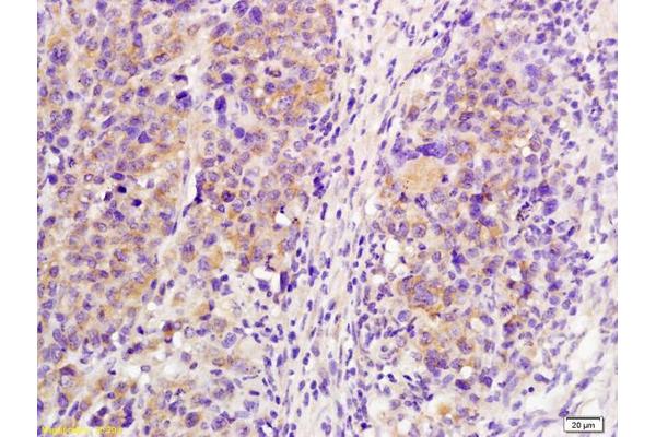 IL21 Receptor antibody  (AA 441-538)