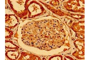 Immunohistochemistry of paraffin-embedded human kidney tissue using ABIN7161298 at dilution of 1:100 (NOTCH2 antibody  (AA 59-250))