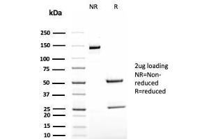 SDS-PAGE Analysis Purified TAG-72 Recombinant Mouse Monoclonal Antibody (rB72. (Recombinant TAG-72 / CA72.4 antibody)