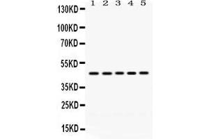 Anti- PGK1 Picoband antibody, Western blottingAll lanes: Anti PGK1  at 0. (PGK1 antibody  (C-Term))