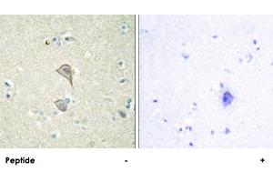 Immunohistochemistry analysis of paraffin-embedded human brain tissue, using NKTR polyclonal antibody .