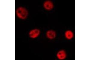 ABIN6275604 staining Hela by IF/ICC. (SF3B4 antibody  (N-Term))