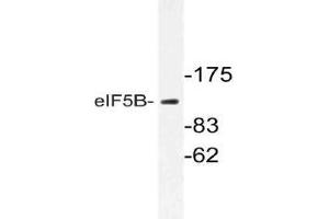 Western blot (WB) analysis of eIF5B antibody in extracts from Jurkat cells. (EIF5B antibody)