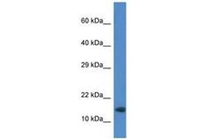 Image no. 1 for anti-Ring Finger Protein 122 (RNF122) (AA 52-101) antibody (ABIN6746212) (RNF122 antibody  (AA 52-101))