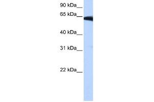 WB Suggested Anti-PIGW Antibody Titration:  0. (PIGW antibody  (Middle Region))