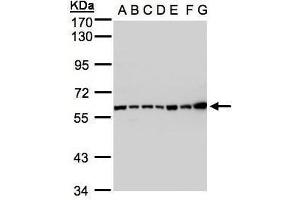 WB Image Sample(30 ug whole cell lysate) A: 293T B: A431 , C: H1299 D: HeLa S3 , E: Hep G2 , F: MOLT4 , G: Raji , 7. (Complement C2 antibody)