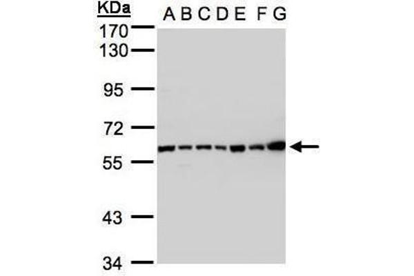Complement C2 antibody