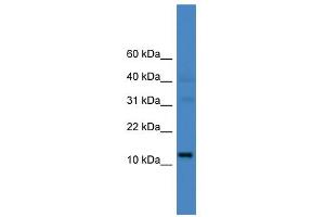 WB Suggested Anti-C14orf48 Antibody Titration: 0. (LINC00521 antibody  (N-Term))
