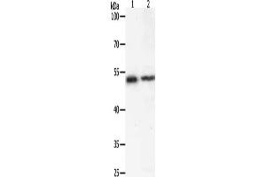 Gel: 10 % SDS-PAGE, Lysate: 40 μg, Lane 1-2: Human liver cancer tissue, 293T cells, Primary antibody: ABIN7192602(SOX1 Antibody) at dilution 1/400, Secondary antibody: Goat anti rabbit IgG at 1/8000 dilution, Exposure time: 20 seconds (SOX1 antibody)