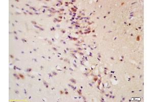 Formalin-fixed and paraffin embedded: rat brain tissue labeled with Anti-Tau protein Polyclonal Antibody , Unconjugated at 1:200 followed by conjugation to the secondary antibody and DAB staining (tau antibody  (AA 681-758))