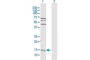 Western Blot analysis of PPIA expression in transfected 293T cell line by PPIA MaxPab polyclonal antibody. (PPIA antibody  (AA 1-165))