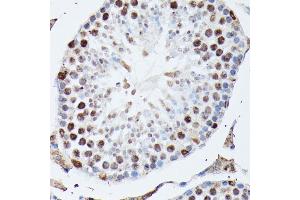 Immunohistochemistry of paraffin-embedded mouse testis using hnRNPM antibody (ABIN6128031, ABIN6141919, ABIN6141920 and ABIN6222681) at dilution of 1:100 (40x lens). (HNRNPM antibody  (AA 491-730))