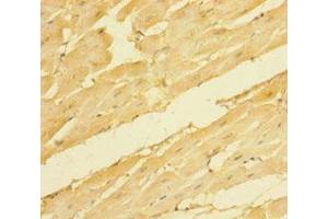 Immunohistochemistry of paraffin-embedded human heart tissue using ABIN7161234 at dilution of 1:100