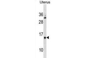 GALNTL5 Antibody (N-term) (ABIN1881361 and ABIN2838787) western blot analysis in human Uterus tissue lysates (35 μg/lane).