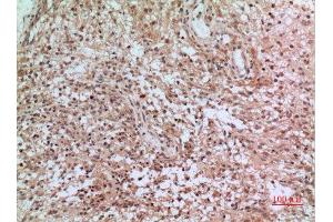 Immunohistochemistry (IHC) analysis of paraffin-embedded Human Brain, antibody was diluted at 1:100. (CD3D antibody  (Internal Region))