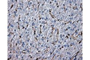 Immunohistochemical staining of paraffin-embedded liver tissue using anti-PSMC3mouse monoclonal antibody.