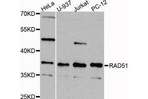 Western blot analysis of extracts of various cell lines, using RAD51 antibody (ABIN5973699) at 1/1000 dilution. (RAD51 antibody)
