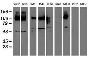 Image no. 2 for anti-CUB Domain Containing Protein 1 (CDCP1) antibody (ABIN1497412) (CDCP1 antibody)