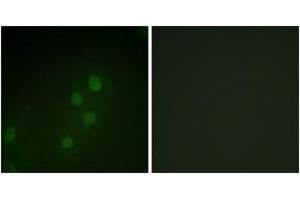 Immunofluorescence analysis of HeLa cells, using MYF5 (Ab-49) Antibody. (MYF5 antibody  (AA 21-70))
