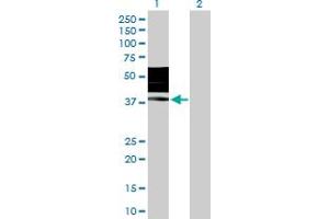 Western Blot analysis of KIR2DL3 expression in transfected 293T cell line by KIR2DL3 MaxPab polyclonal antibody. (KIR2DL3 antibody  (AA 1-341))