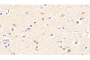 Detection of CHRNb2 in Human Cerebrum Tissue using Polyclonal Antibody to Cholinergic Receptor, Nicotinic, Beta 2 (CHRNb2) (CHRNB2 antibody  (AA 86-244))