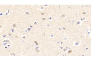 Detection of CHRNb2 in Human Cerebrum Tissue using Polyclonal Antibody to Cholinergic Receptor, Nicotinic, Beta 2 (CHRNb2) (CHRNB2 antibody  (AA 86-244))
