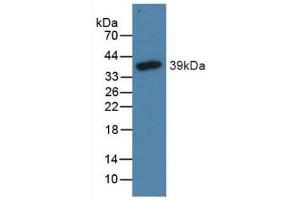 Detection of Recombinant NT-ProBNP, Canine using Polyclonal Antibody to N-Terminal Pro-Brain Natriuretic Peptide (NT-ProBNP) (NT-ProBNP antibody  (AA 18-106))