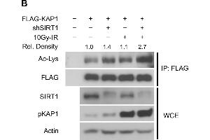 Western Blotting (WB) image for anti-Acetylated Lysine antibody (ABIN5596809)