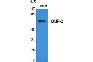 Western Blot (WB) analysis of specific cells using BMP-2 Polyclonal Antibody.