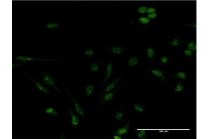Immunofluorescence of monoclonal antibody to GEMIN4 on HeLa cell. (GEMIN4 antibody  (AA 959-1057))