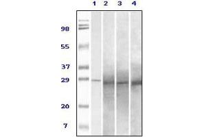 Western Blotting (WB) image for anti-RAB25, Member RAS Oncogene Family (RAB25) antibody (ABIN1844336) (RAB25 antibody)