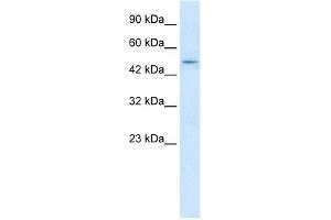 WB Suggested Anti-ZNF651 Antibody Titration:  2. (ZBTB47 antibody  (N-Term))