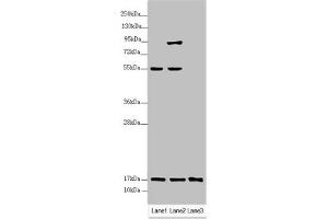 Western blot All lanes: UXT antibody at 3. (UXT antibody  (AA 1-157))