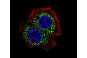 Fluorescent confocal image of MCF-7 cell stained with Estrogen Receptor antibody at 1:25.