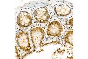 Immunohistochemistry of paraffin-embedded rat colon using [KO Validated] NADPH oxidase 4 (NOX4) Rabbit pAb (ABIN6128328, ABIN6144752, ABIN6144753 and ABIN6215143) at dilution of 1:100 (40x lens). (NADPH Oxidase 4 antibody  (AA 328-578))