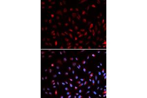 Immunofluorescence analysis of U2OS cells using ERCC1 antibody. (ERCC1 antibody  (AA 1-323))