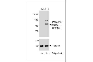 Western blot analysis of lysates from MCF-7 cell line, untreated or treated with Calyculin A, 100nM, using (ABIN6241058 and ABIN6578964) (upper) or Tubulin (lower). (SSH3 antibody  (pSer37))