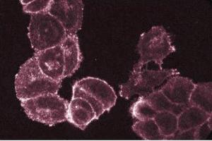 Immunofluorescent staining of A431 cells with anti-fyn antibody. (FYN antibody  (AA 1-132))