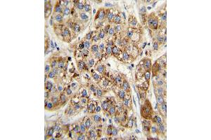 Immunohistochemistry (IHC) image for anti-Methylcrotonoyl-CoA Carboxylase 2 (Beta) (MCCC2) antibody (ABIN3002883) (MCCC2 antibody)